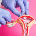 What is the Average Cost of Medical Tests and Procedures in Louisville, KY?